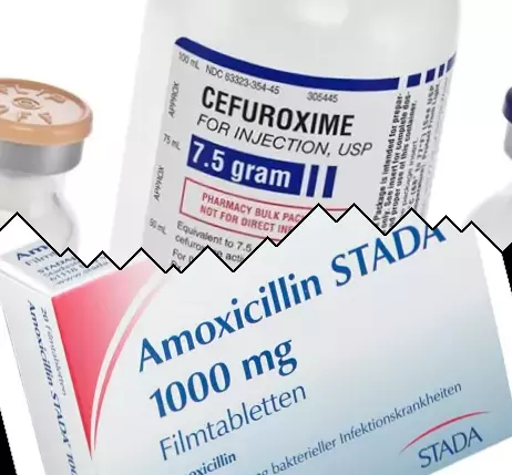 Cefuroxima contra Amoxicilina